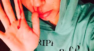 Miley Cyrus publica una foto con su nariz sangrando