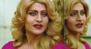 Un hombre de 27 años se gasta 175.000 dólares en parecerse a Madonna