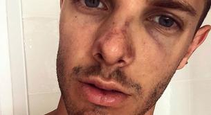 Brutal ataque homófobo en Sitges