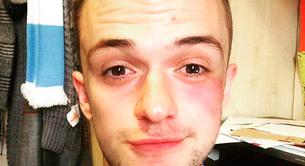 La valiente carta de este joven gay a sus agresores homófobos