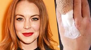 Lindsay Lohan pierde parte de un dedo en un terrible accidente