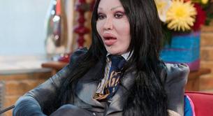 Muere Pete Burns de Dead Or Alive a los 57 años