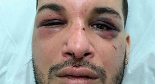 Secuestran y torturan durante dos días a un activista LGBT en Francia