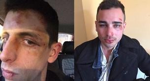 La brutal agresión homófoba a dos chicos en Berga