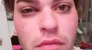 Sema, víctima de un ataque homófobo