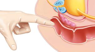 La guía del sexo anal de Teen Vogue genera gran controversia