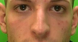 Cárcel para un hombre gay por infectar con VIH a otros dos