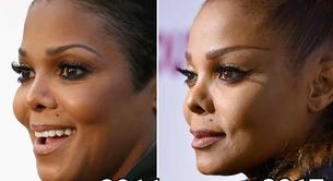 ¿Se le está cayendo la nariz a Janet Jackson?