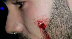 Agresión homófoba al primo de Andrea Duro en la discoteca Jowke de Alcorcón