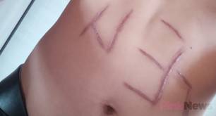 Le rajan el estómago para escribir "GAY" en un ataque homófobo