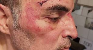 Un gay llamado "jodido maricón", golpeado por 12 atacantes