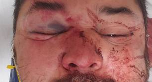 Hombre gay atacado por un grupo de 10 personas